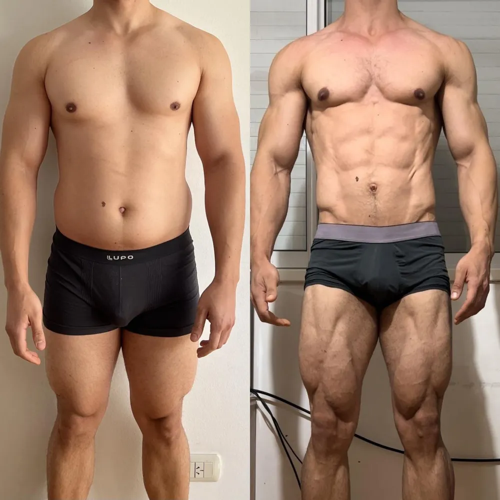Antes e depois de um aluno do Arruda Army — ângulo frente