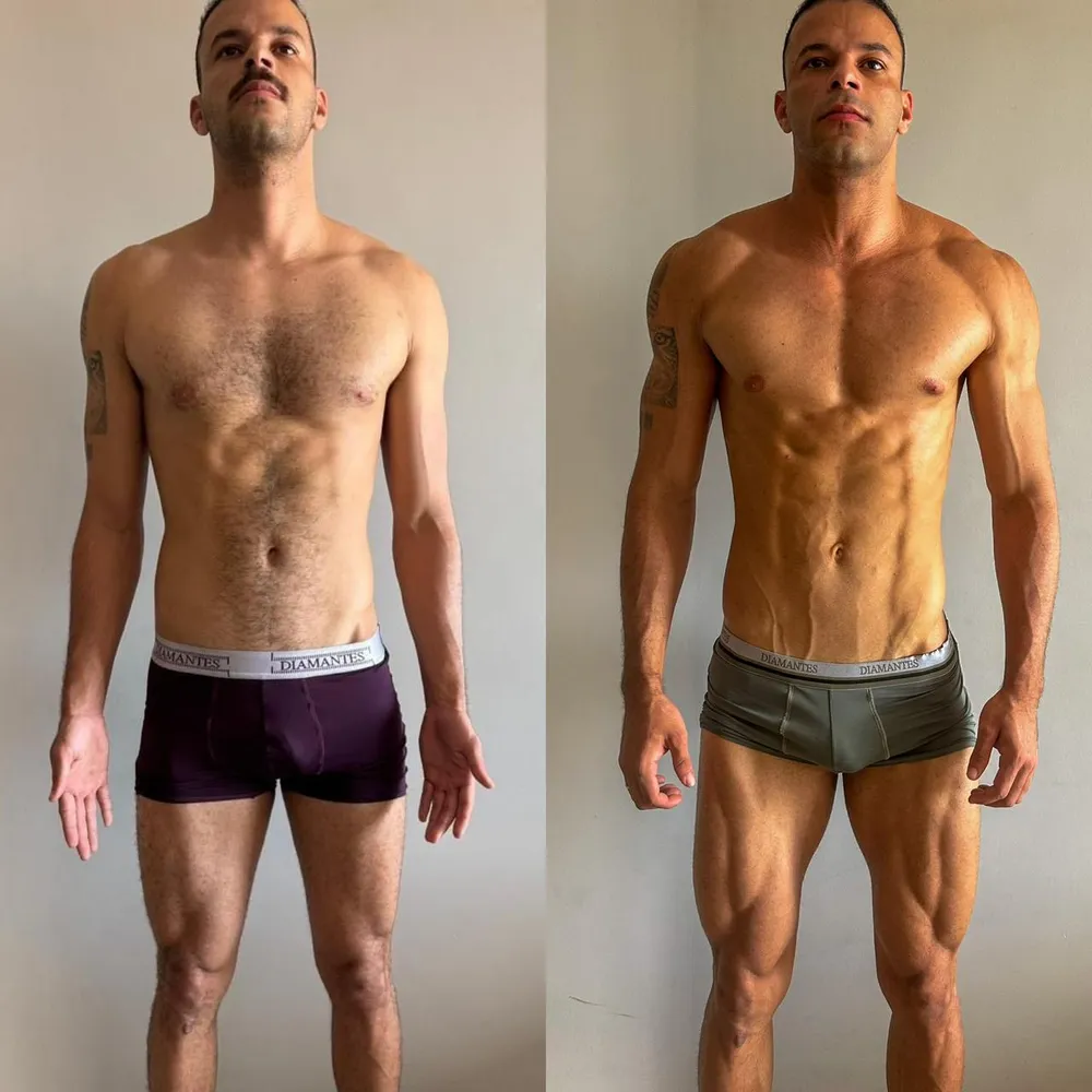 Antes e depois de um aluno do Arruda Army — ângulo frente