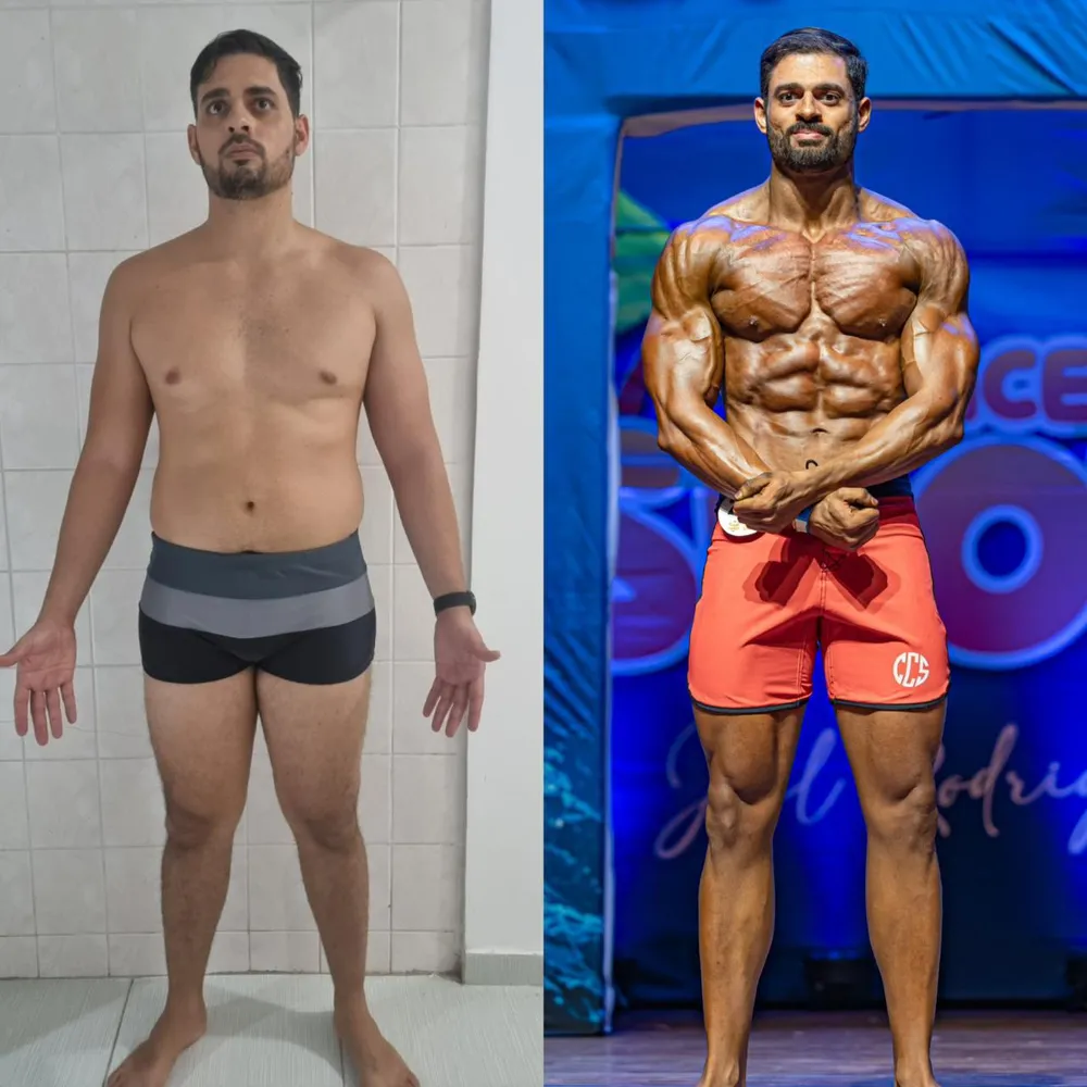Antes e depois de um aluno do Arruda Army — ângulo frente